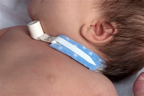 DALE Tracheostomy Tube Holder KK 242 10 Stück